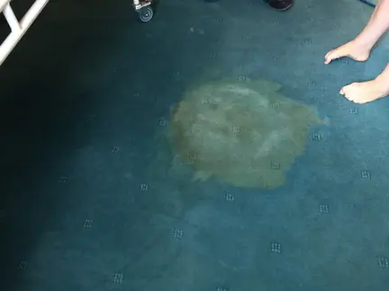 Reduce urine stain Glengormely
